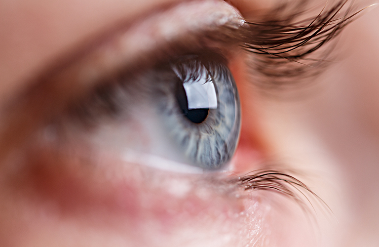 Astigmatizem | Očesne bolezni | Očesna Optika Vogrič